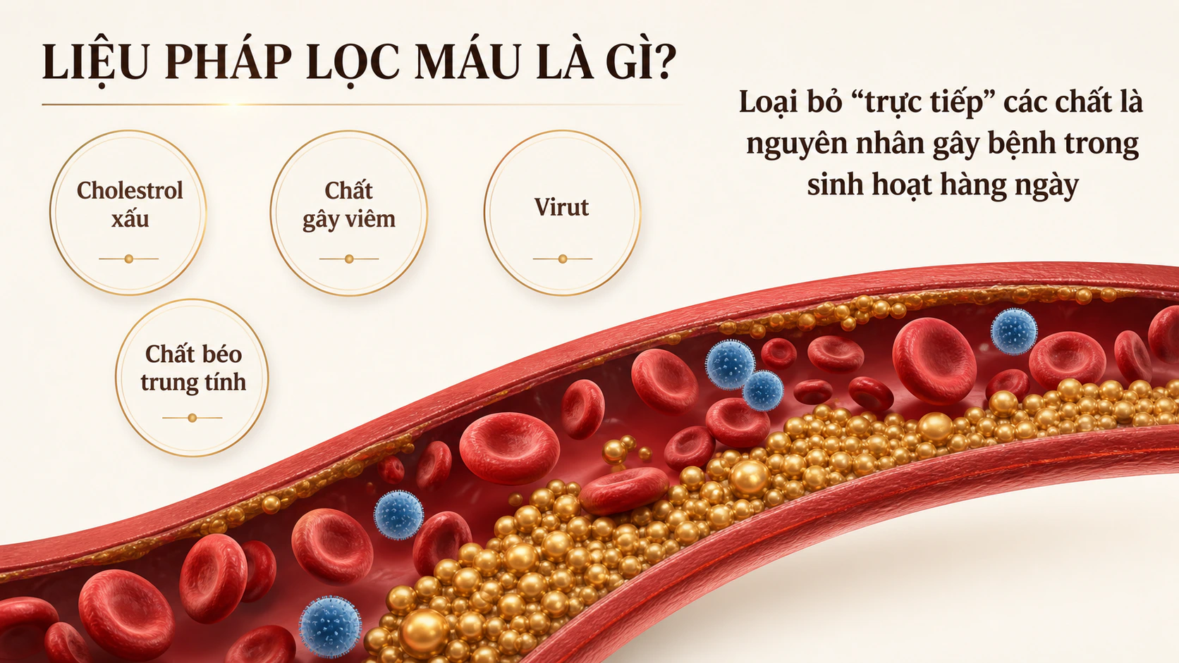 Liệu pháp lọc máu